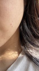 -万州华美紫馨整形美容医院