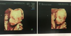 -杭州贝瑞斯美华妇儿医院·早孕·产检·儿科