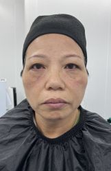 -天津健丽·去眼袋医疗美容机构