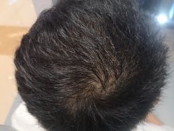 -可貌丽姿·增发养发