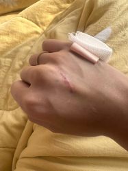 点击看大图 体验后-上海宏康医院·医疗美容科