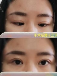 -美莱医学美容医院