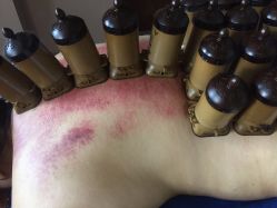 -御品•瑶浴灸疗SPA