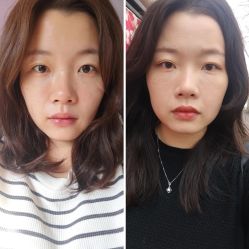-Yestar 嘉兴艺星医疗美容医院