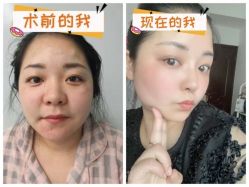 -素美医疗美容·西南眼鼻整形·修复基地
