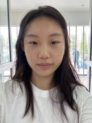 -成都西区医院整形美容