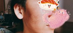 -北京米扬丽格医疗美容·联合丽格鼻整形中心