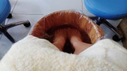 -派恩宜灰指甲·甲沟炎·鸡眼康护