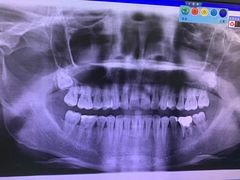 -上海市普陀区中心医院