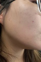 体验后-美莱医学美容医院