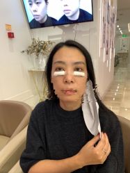 -天津健丽·去眼袋医疗美容机构
