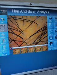 -熙朵美学植发·连锁品牌