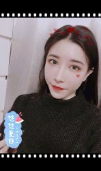 体验后-大麦微针植发全国连锁