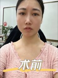 -广东韩妃整形外科医院