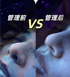 -SKIN79皮肤管理中心