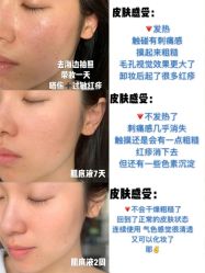 -凡碧诗毛孔收细