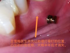 -极光口腔·矫正种植修复(锦江店)