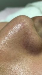 -苑苑vbeauty科技美容SPA