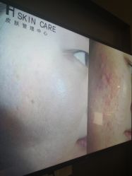 -美壹生诊所皮肤管理中心·海菲秀&Legacy美白舱