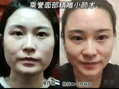 -中粮·祥云小镇