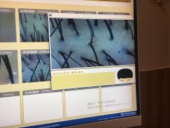 -丝客富脱发养发头皮馆