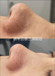 -SKIN79皮肤管理中心
