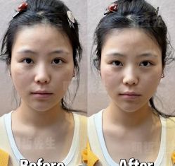 -颜和骨正&明星徒手小颜整骨