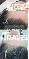 -MISS STAR·半永久纹眉·发际线·美瞳线