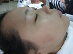 -悟空祛痘·专业祛痘机构