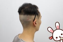 -大麦微针植发丨全国连锁