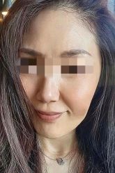 -素美医疗美容·西南眼鼻整形·修复基地