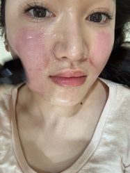 -广州美莱医疗美容医院