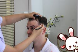 -大麦微针植发丨全国连锁