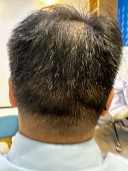 -雍禾植发全国连锁