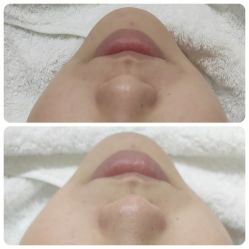 -郡艺医疗美容·微整·眼鼻吸脂