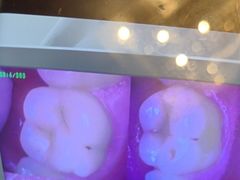 -土豆口腔(凤凰北总店)