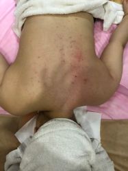 -苑苑vbeauty科技美容SPA