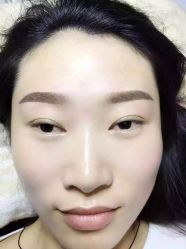 点击看大图 -郡艺医疗美容·微整·眼鼻吸脂