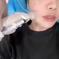 体验后-顾泽医疗美容