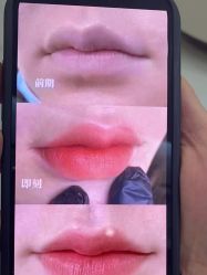 -郡艺医疗美容·微整·眼鼻吸脂