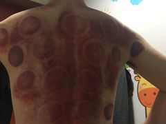 -沈师傅盲人按摩工作室(密三小区店)