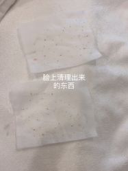 -塑青春&伊肤泉祛痘皮肤管理