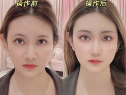 -UP&UP·半永久眉毛眼线机器野生眉