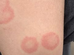 -复旦大学附属华山医院(总院)