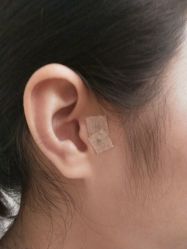 -肥三针腧穴瘦身馆