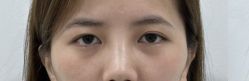 -Yestar重庆艺星医疗美容医院