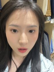 -成都西区医院整形美容