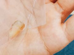 -爱齿尔口腔美学种植中心(永清院)