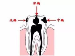-团圆口腔·种植中心(锦江院区)