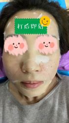 -新美荟医美·专注面部美学抗衰